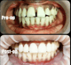 Slider image (10) Dr. A & T Dental Experts